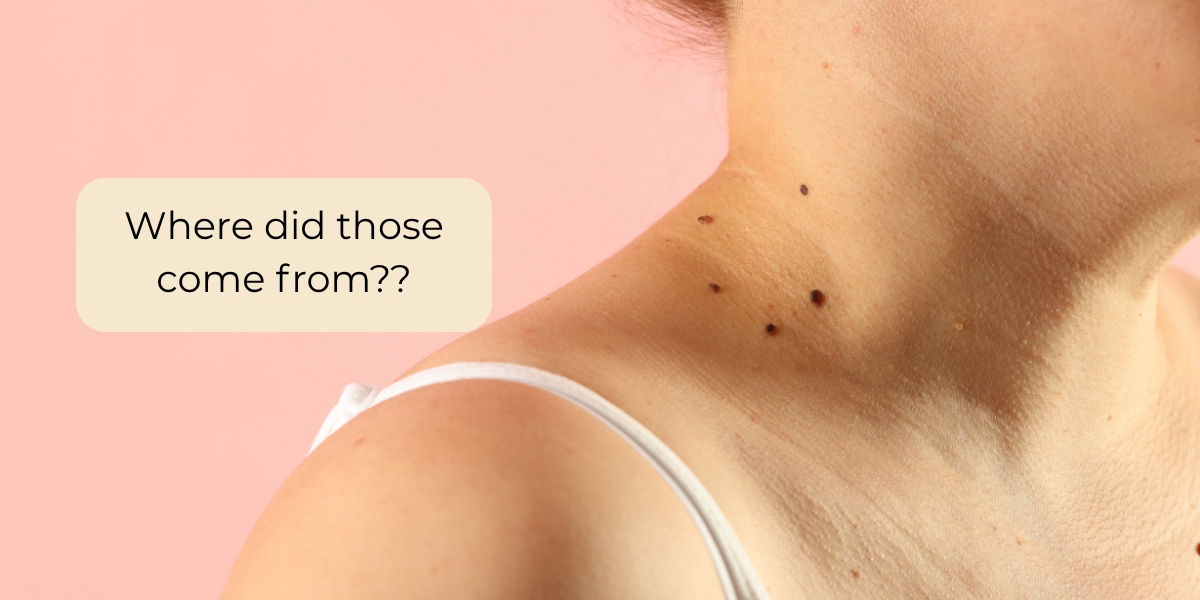 The Bumps and Spots Nobody Tells You About